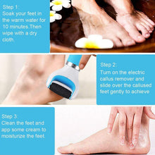 0229 Electronic Dry Foot File, Callous Remover for Feet, Electric Foot with Roller Hard and Dead Skin- Regular Coarse, Baby smooth feet in minutes. For in home padicure foot care, Battery Powered & USB (Battery not included)